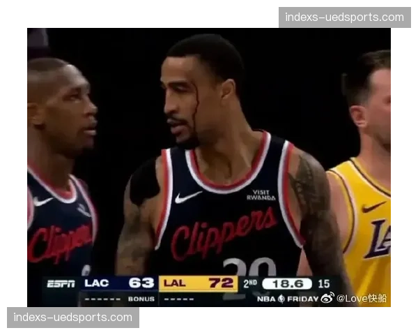 快船伦纳德已移出伤病名单 哈登拇指伤势赛前决定